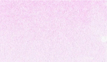 Fluo Pink 003